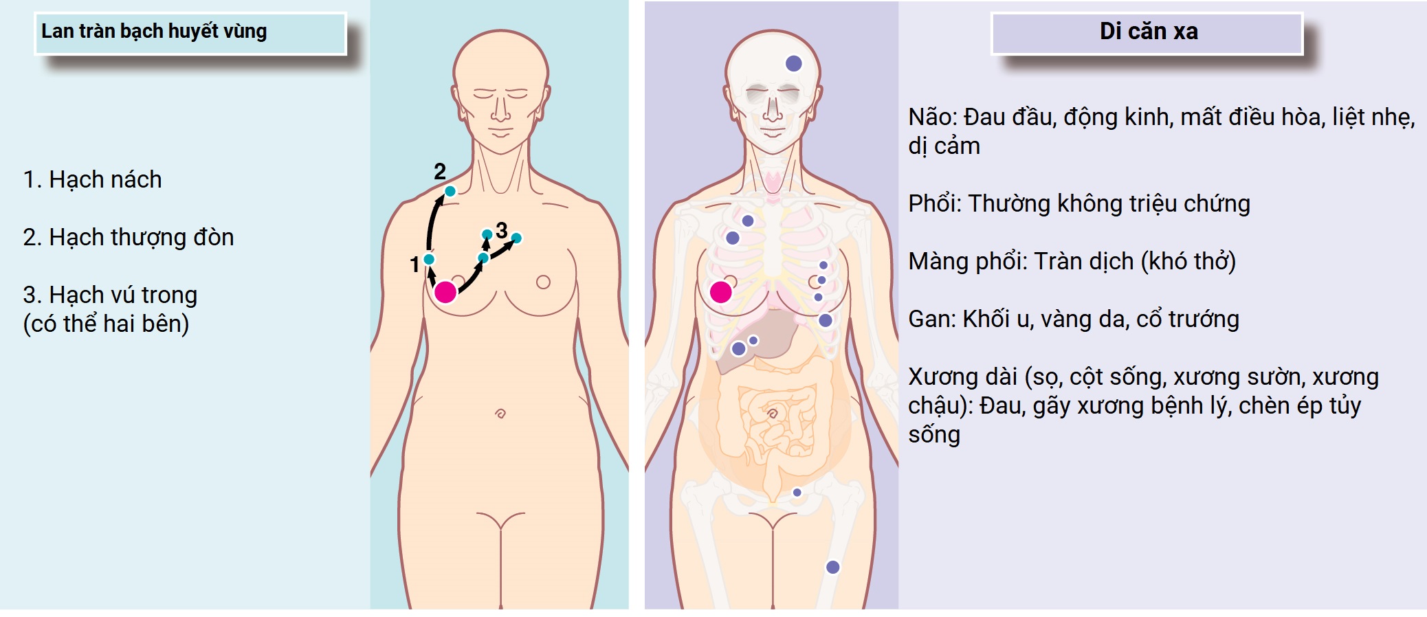 Ngoại khoa Căn bản: Vấn đề, Chẩn đoán và Quản lý, Ấn bản thứ 7 (2026). CHƯƠNG 44. CÁC RỐI LOẠN VỀ TUYẾN VÚ Ngoại khoa Căn bản: Vấn đề, Chẩn đoán và Quản lý, Ấn bản thứ 7 (2026). CHƯƠNG 44. CÁC RỐI LOẠN VỀ TUYẾN VÚ