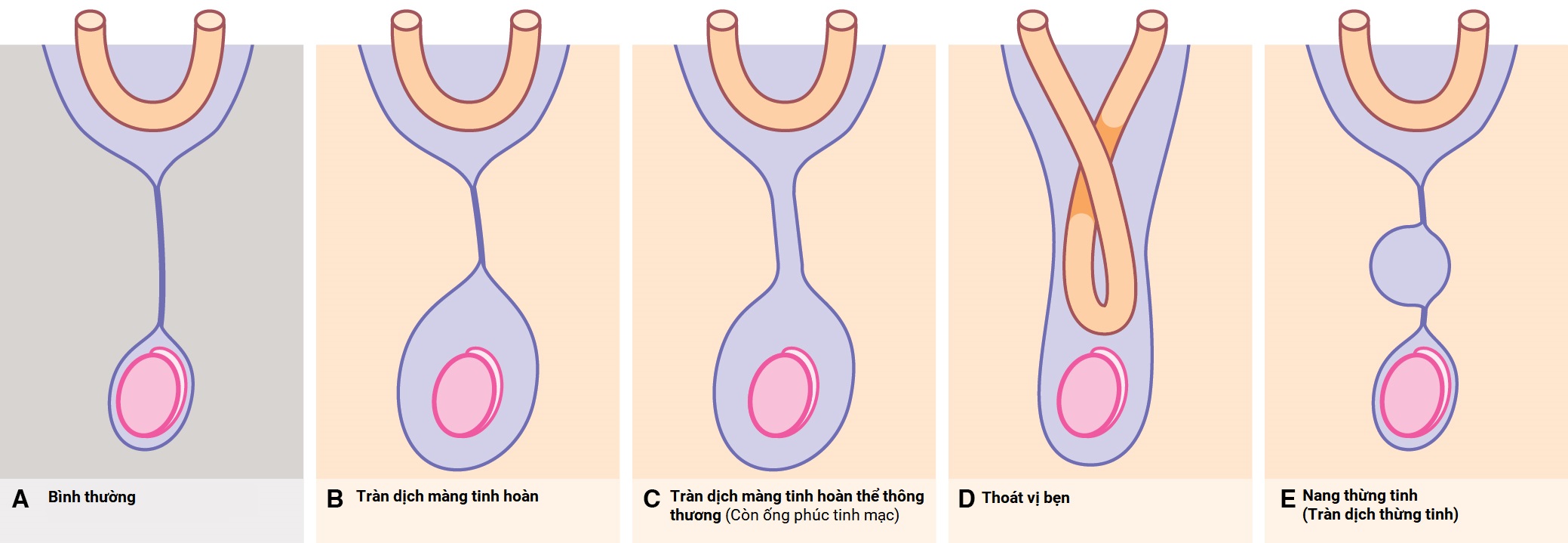 Ngoại khoa Căn bản: Vấn đề, Chẩn đoán và Quản lý, Ấn bản thứ 7 (2026). CHƯƠNG 50 (HẾT). CÁC VẤN ĐỀ BỤNG VÀ TIẾT NIỆU KHÔNG CẤP CỨU Ở TRẺ EM Ngoại khoa Căn bản: Vấn đề, Chẩn đoán và Quản lý, Ấn bản thứ 7 (2026). CHƯƠNG 50 (HẾT). CÁC VẤN ĐỀ BỤNG VÀ TIẾT NIỆU KHÔNG CẤP CỨU Ở TRẺ EM