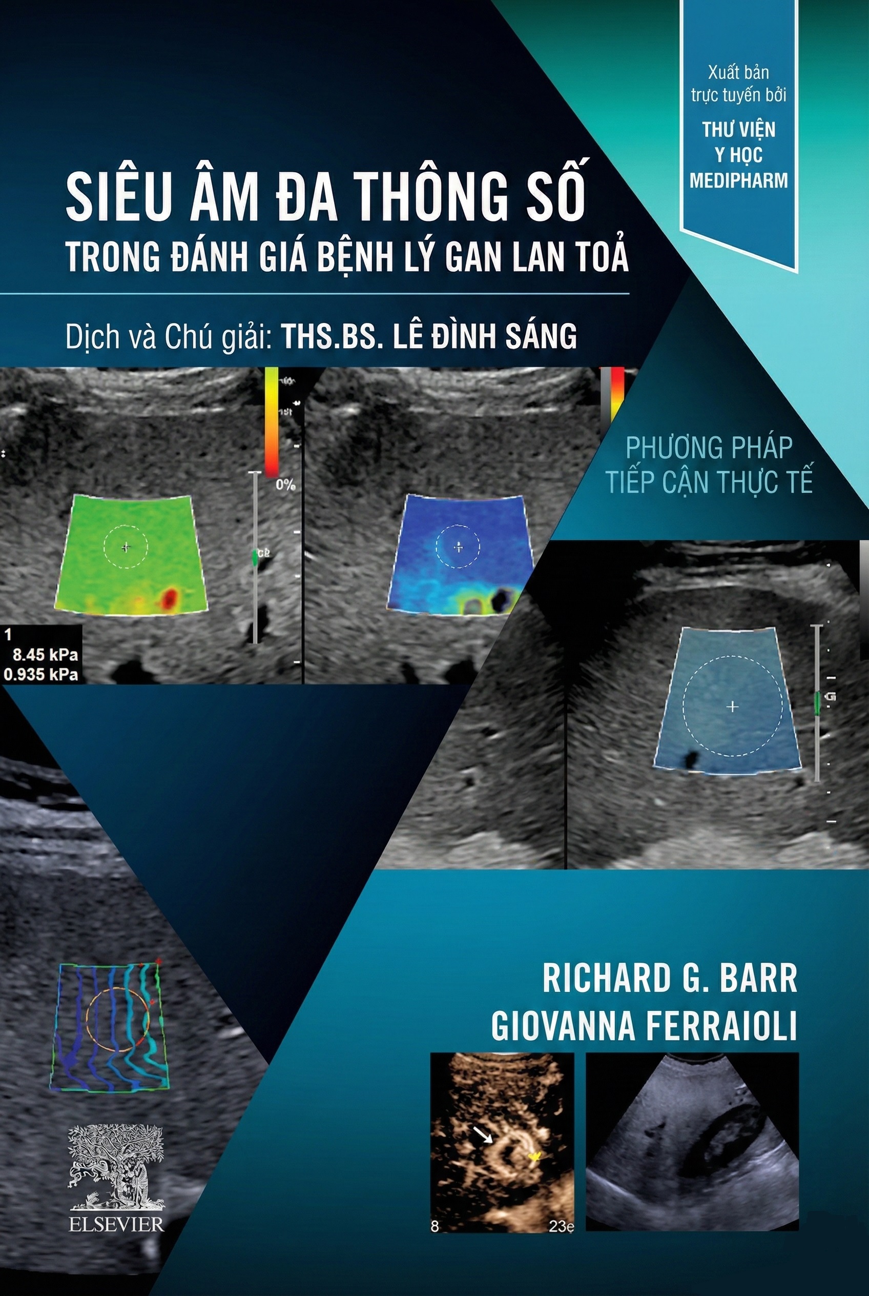 Siêu âm Đa tham số trong Đánh giá Bệnh lý Gan Lan tỏa. CHƯƠNG 13. CÁC TỔN THƯƠNG GAN KHU TRÚ TRÊN NỀN BỆNH LÝ GAN MẠN TÍNH Siêu âm Đa tham số trong Đánh giá Bệnh lý Gan Lan tỏa. CHƯƠNG 13. CÁC TỔN THƯƠNG GAN KHU TRÚ TRÊN NỀN BỆNH LÝ GAN MẠN TÍNH