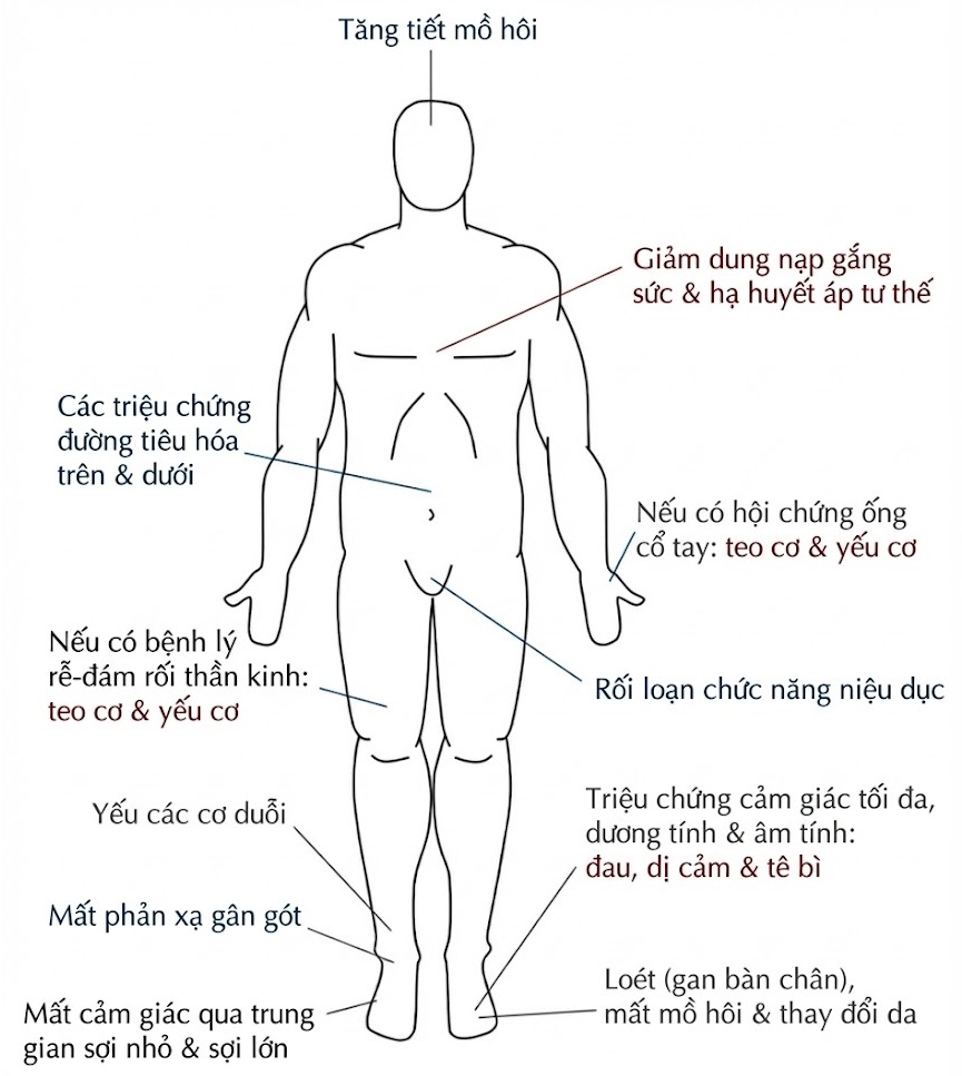 Bệnh lý Thần kinh Đái tháo đường. CHƯƠNG 21 (HẾT). CÁC ĐẶC ĐIỂM LÂM SÀNG TẠI GIƯỜNG BỆNH VÀ CÁC NGHIÊN CỨU ỨNG DỤNG SƠ LƯỢC VỀ BỆNH ĐA DÂY THẦN KINH ĐÁI THÁO ĐƯỜNG Bệnh lý Thần kinh Đái tháo đường. CHƯƠNG 21 (HẾT). CÁC ĐẶC ĐIỂM LÂM SÀNG TẠI GIƯỜNG BỆNH VÀ CÁC NGHIÊN CỨU ỨNG DỤNG SƠ LƯỢC VỀ BỆNH ĐA DÂY THẦN KINH ĐÁI THÁO ĐƯỜNG