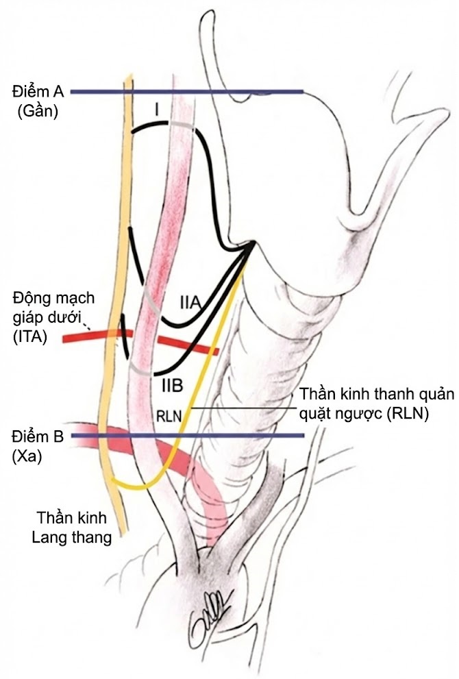 PHẪU THUẬT TUYẾN GIÁP VÀ TUYẾN CẬN GIÁP, ẤN BẢN THỨ 3. CHƯƠNG 36. GIẢI PHẪU PHẪU THUẬT VÀ THEO DÕI THẦN KINH THANH QUẢN QUẶT NGƯỢC PHẪU THUẬT TUYẾN GIÁP VÀ TUYẾN CẬN GIÁP, ẤN BẢN THỨ 3. CHƯƠNG 36. GIẢI PHẪU PHẪU THUẬT VÀ THEO DÕI THẦN KINH THANH QUẢN QUẶT NGƯỢC