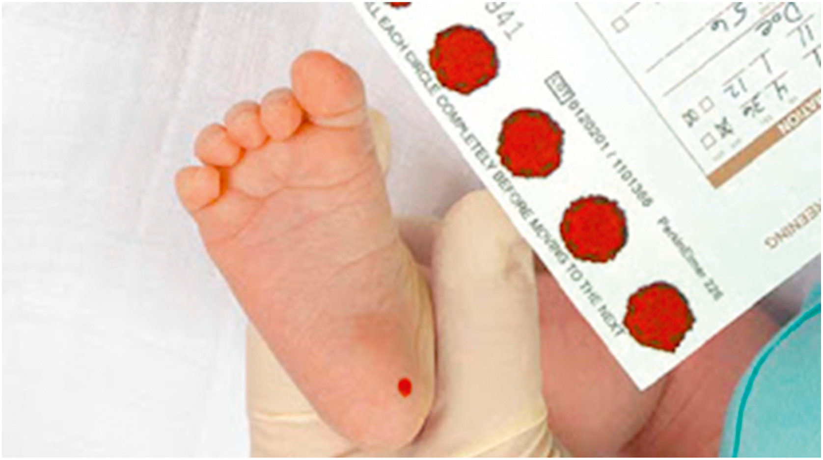 Nội tiết học Bà mẹ – Thai Nhi và Sơ Sinh (Ấn bản thứ 2, 2026). CHƯƠNG 43. CÁC RỐI LOẠN CHỨC NĂNG TUYẾN GIÁP Ở THAI NHI VÀ SAU SINH