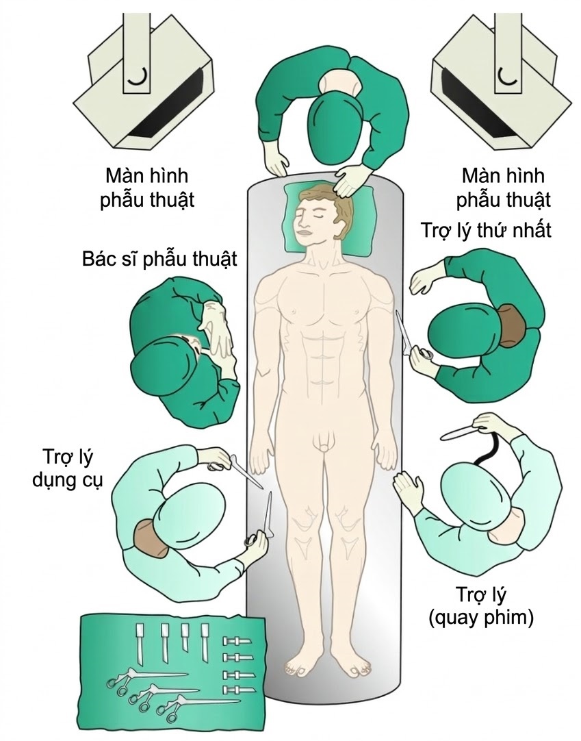 PHẪU THUẬT TUYẾN GIÁP VÀ TUYẾN CẬN GIÁP, ẤN BẢN THỨ 3. CHƯƠNG 58. PHẪU THUẬT CẮT TUYẾN CẬN GIÁP XÂM LẤN TỐI THIỂU CÓ VIDEO HỖ TRỢ