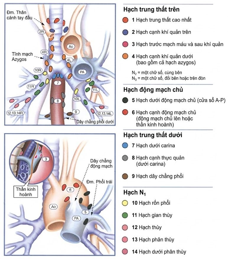 Ung thư Phổi – Cách tiếp cận Quản lý Đa ngành Dựa trên bằng chứng. CHƯƠNG 4. NHỮNG CÂN NHẮC NGOẠI KHOA TRONG ĐIỀU TRỊ UNG THƯ PHỔI