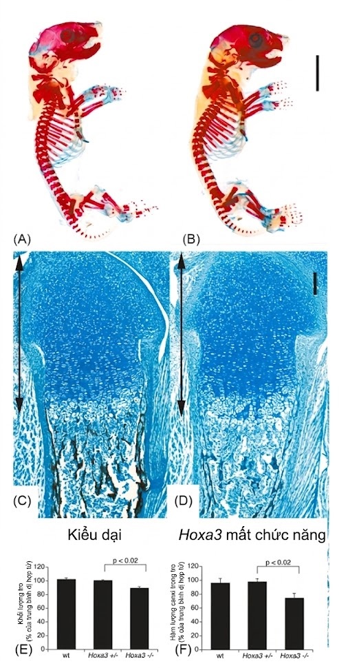 Nội tiết học Bà mẹ – Thai Nhi và Sơ Sinh (Ấn bản thứ 2, 2026). CHƯƠNG 44: CÁC RỐI LOẠN CHUYỂN HÓA CANXI, PHỐT PHO VÀ XƯƠNG TRONG QUÁ TRÌNH PHÁT TRIỂN CỦA THAI NHI VÀ TRẺ SƠ SINH