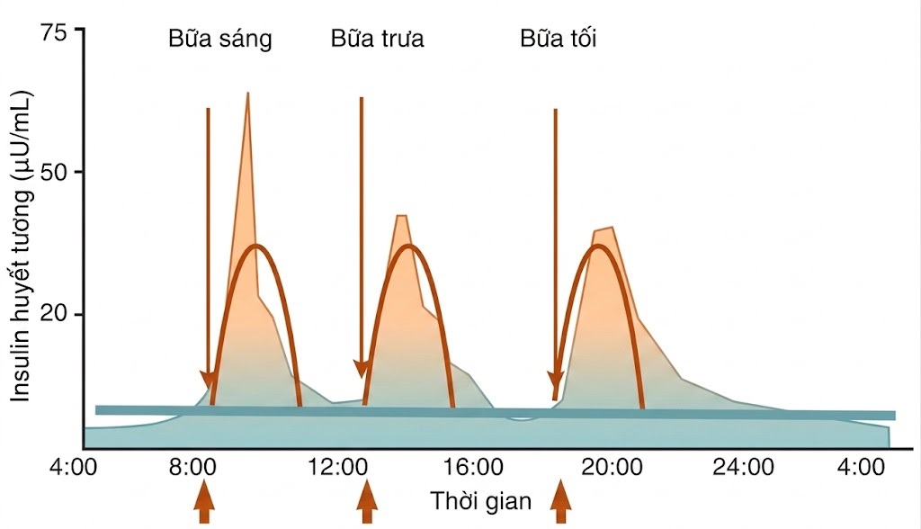 Hỏi & Đáp Nội tiết học lâm sàng, Ấn bản thứ 8 (2026). CHƯƠNG 3. ĐÁI THÁO ĐƯỜNG TÍP 1